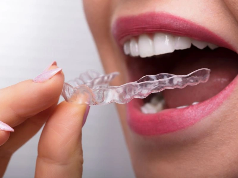 invisalign is the perfect way