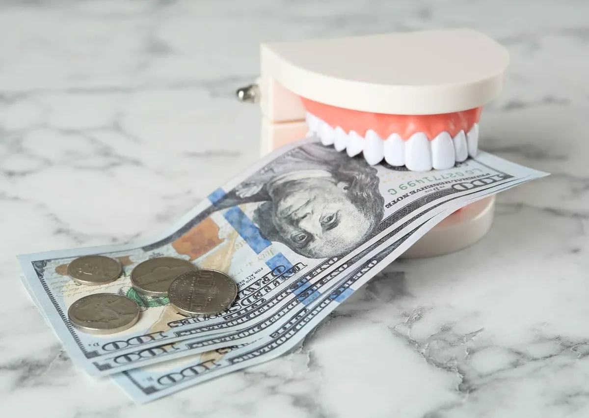 Dental model with cash and coins representing teeth bonding cost and treatment expenses.